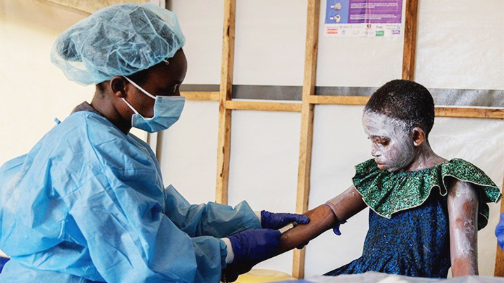 Căn bệnh nguy hiểm từ châu Phi