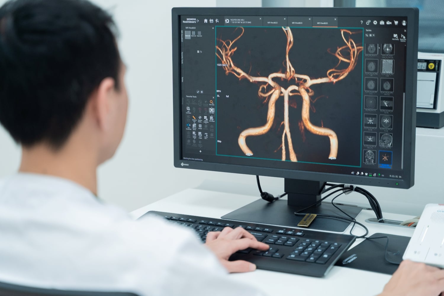 'Siêu máy' chụp cộng hưởng từ MRI 3.0 lần đầu có mặt tại bệnh viện Việt 3